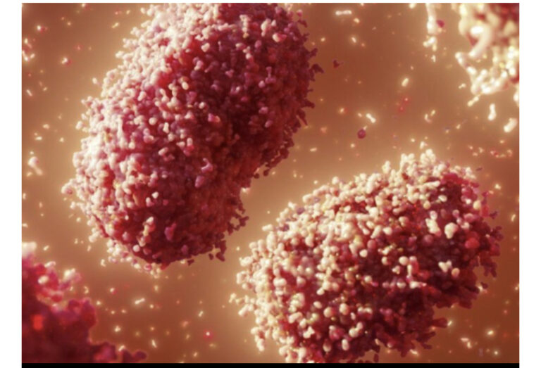 No cases of monkey pox found in Ghana