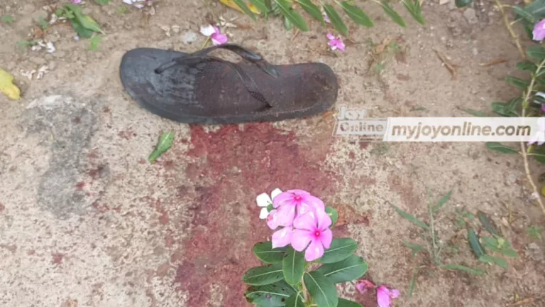 Man Cuts Off Friend’s Hand St Millennium City In Gomoa East